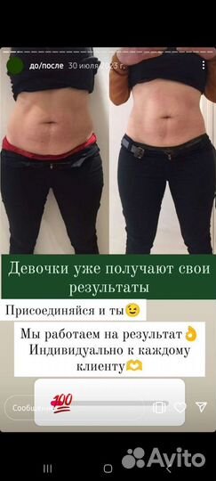 Аппаратный антицеллюлитный массаж