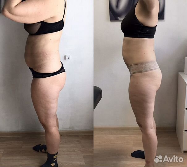 Массаж, похудение