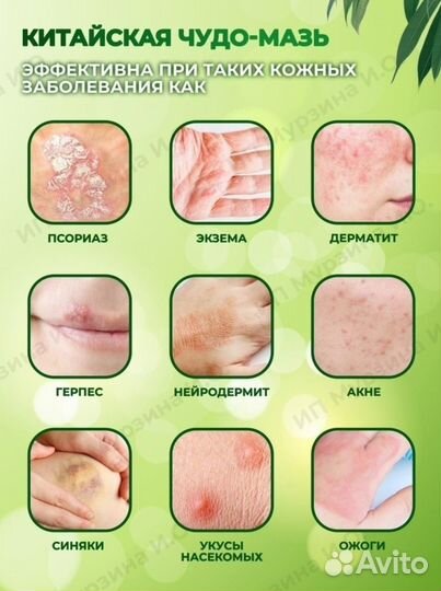 Мазь от псориаза