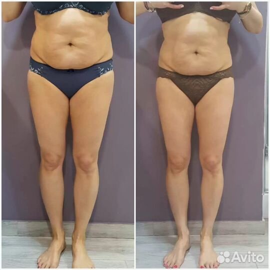 LPG массаж на аппарате оригинал пр-ва Франции