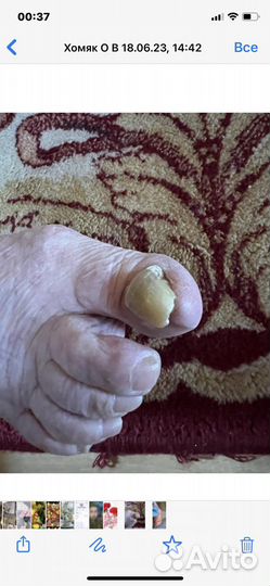 Подология, педикюр, маникюр