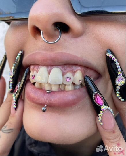 Установка скайсов