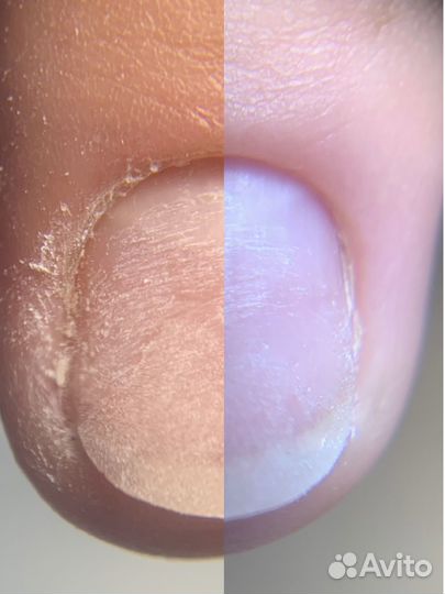 Маникюр на дому