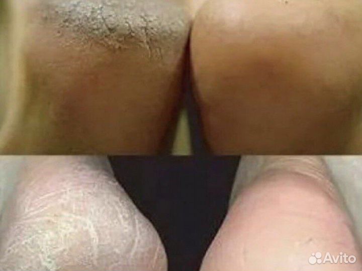 Выезд на дом Педикюр всем, и бабушки и дедушки