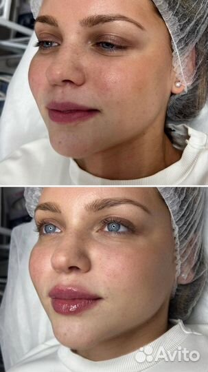 Косметолог Подольск Массаж Чистка лица Ботокс