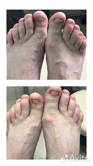 Педикюр подолог выезд на дом