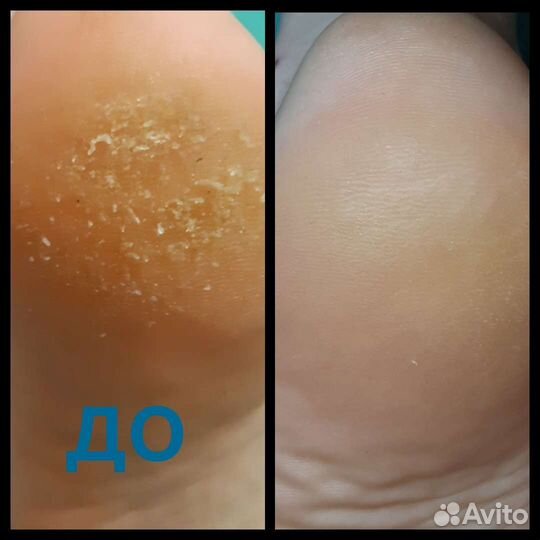 Маникюр и педикюр