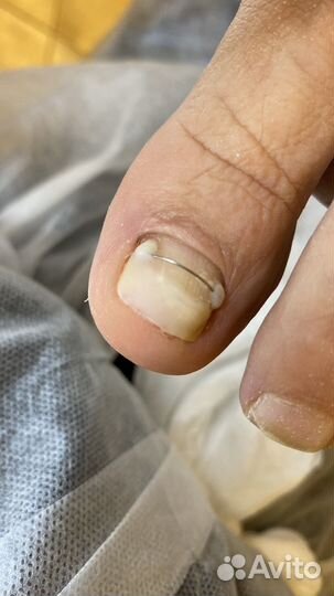 Услуги подолога