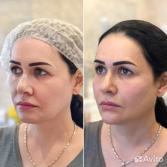 Векторный лифтинг лица