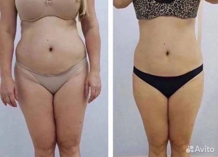 Кавитация, Биофотон, Вакуумный массаж, Шугаринг