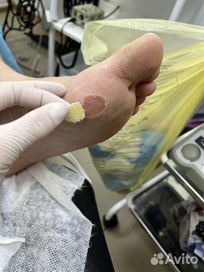 Медицинский педикюр. Подолог