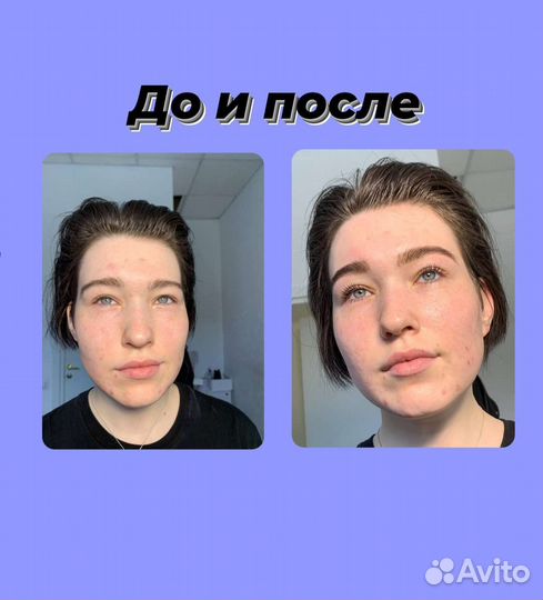 Брови, ресницы