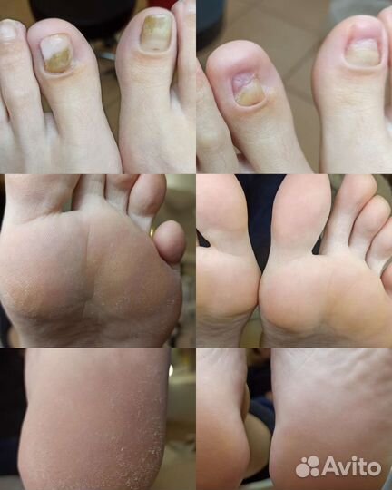 Педикюр/ подолог
