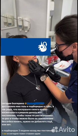 Увеличение губ. Без боли