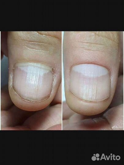 Маникюр педикюр на дому