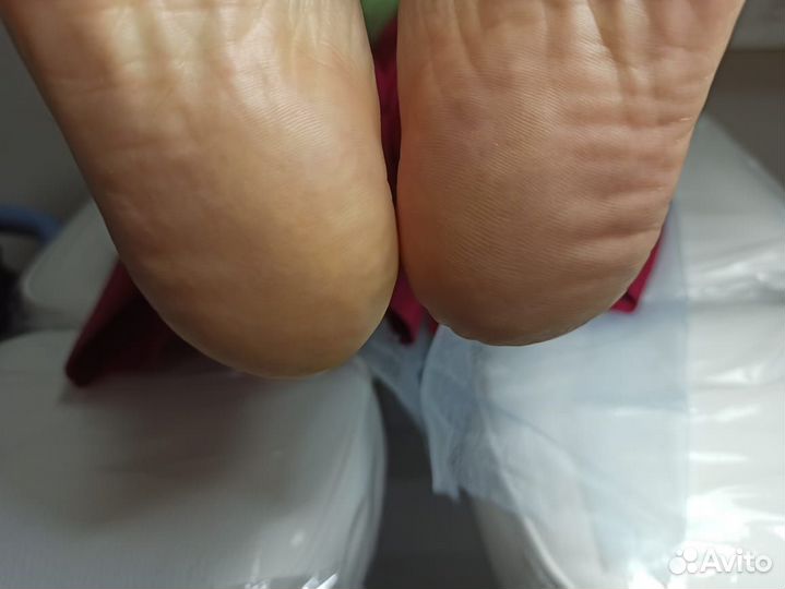 Педикюр парамедицинский, подолог