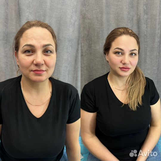 Модель на увеличение губ