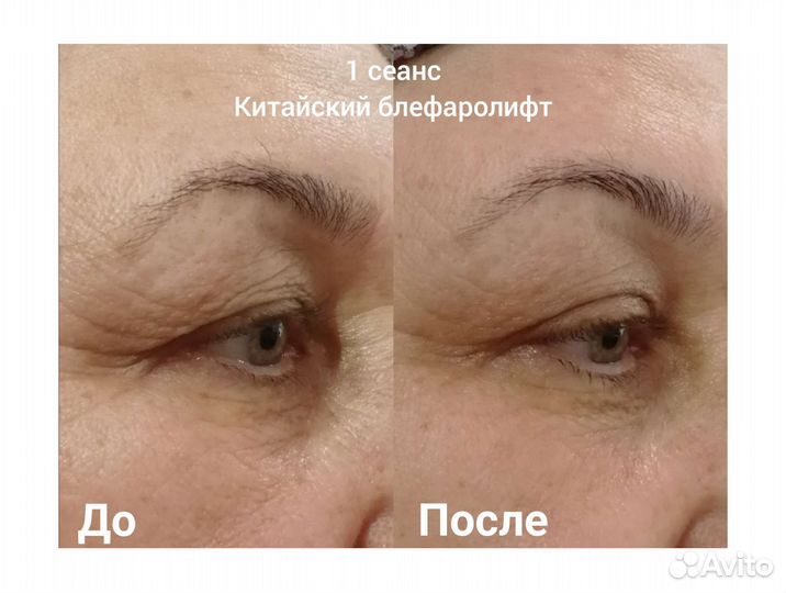 Массаж лица