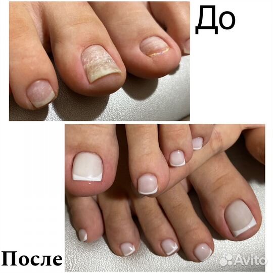 Маникюр и педикюр