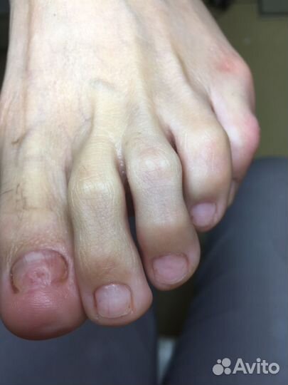 Услуги подолога / выезд на дом