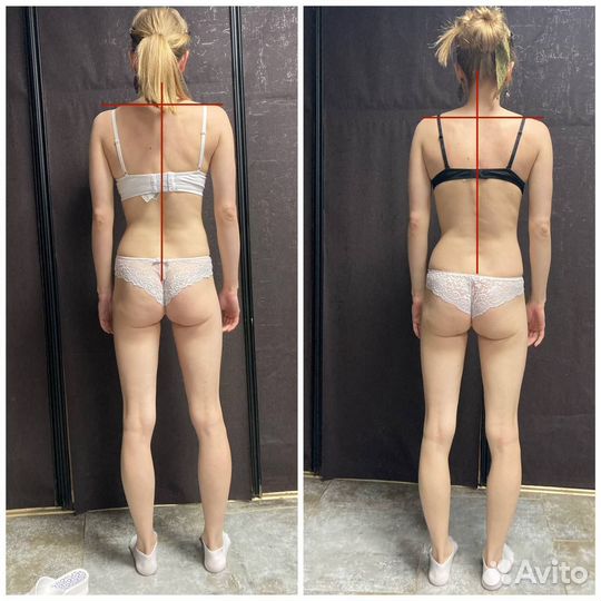 Глубокомышечный точечный массаж триггерных зон