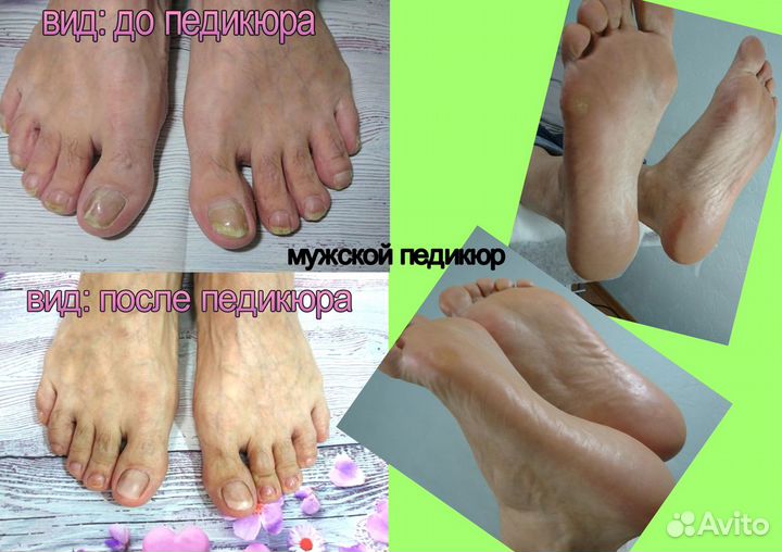 Педикюр
