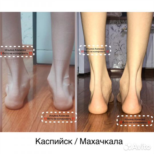 Детский Массаж на дому