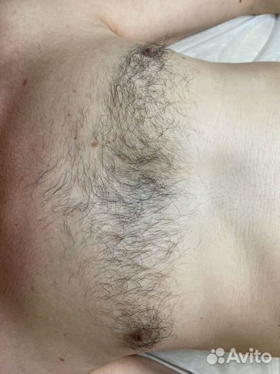 Мужская депиляция, по предоплате