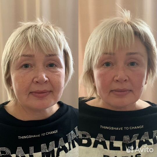 Холодная плазма