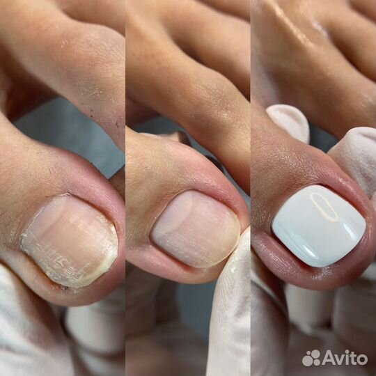 Подолог с медицинским образованием