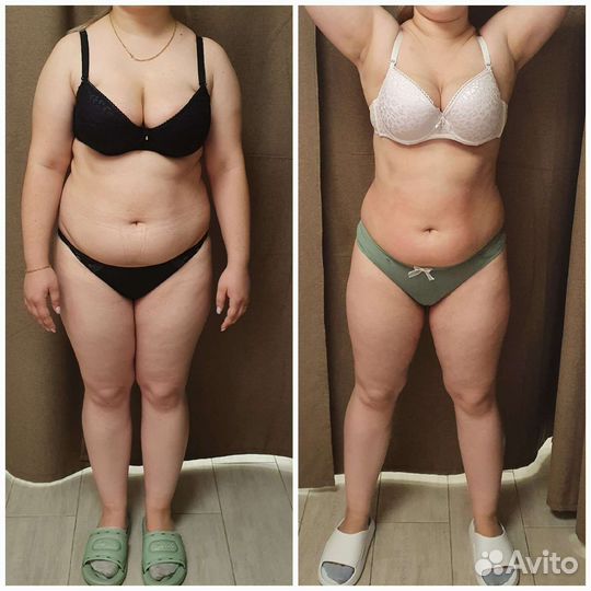 Криолиполиз, кавитация, ваккумный массаж