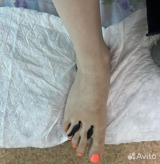 Купон на гирудотерапию