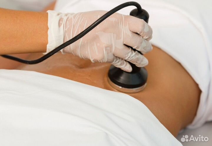 Кавитация. До - 30 целлюлита в ягодицах за курс