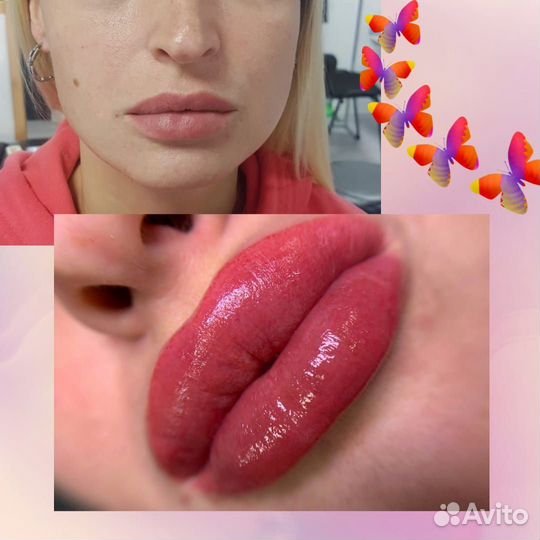 Перманентный татуаж,перекрытие,удаление,лазер