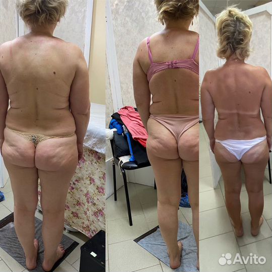 Коррекция фигуры