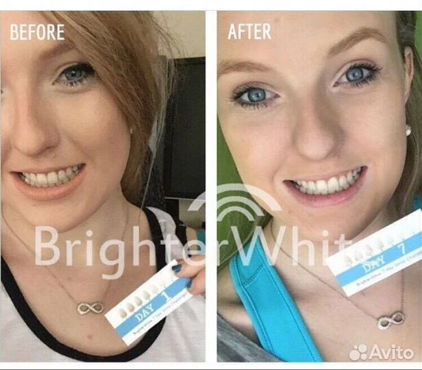 Оригинал. Система для домашнего отбеливания зубов