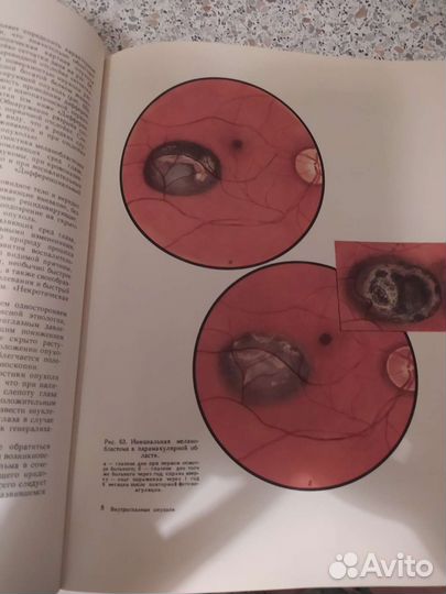 Офтальмология