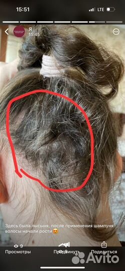 Чудо шампунь лечебный