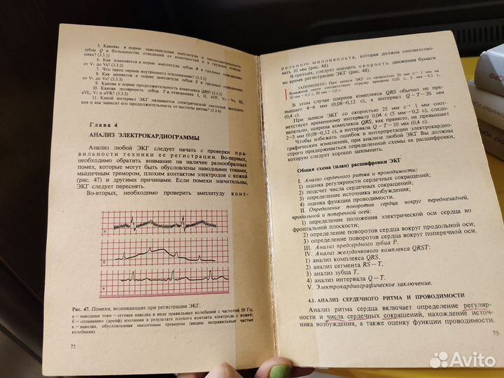 Электрокардиография Мурашко скрутынский СССР