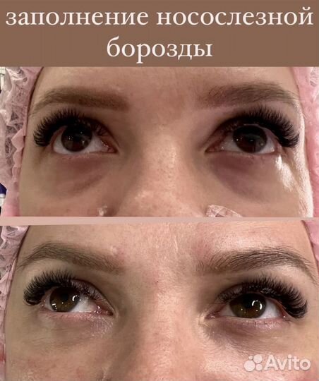 Услуги косметолога