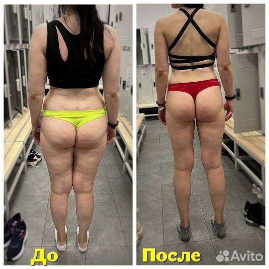 Мадеротерапия, массаж