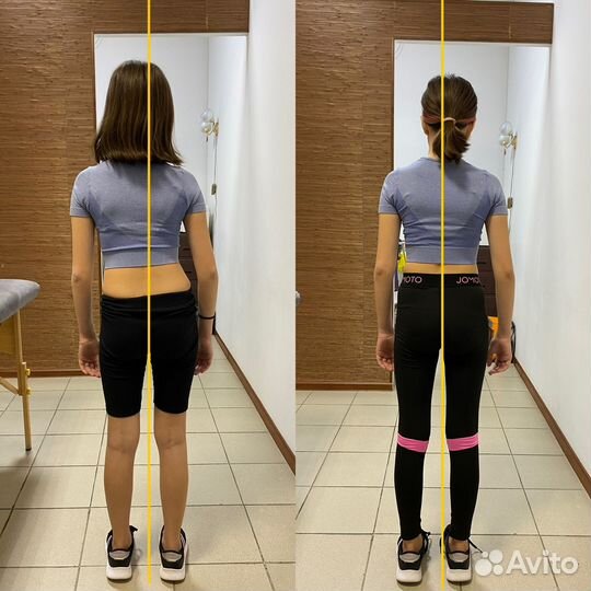 Реабилитация, Массаж, лфк