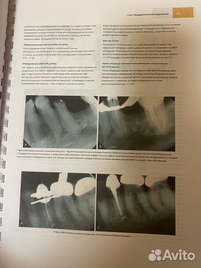 Распечатанная книга по Эндодонтии