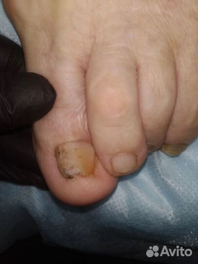 Маникюр педикюр наращивание ногтей