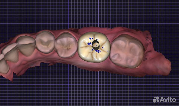 Зубной техник. Моделировка ExoCad. Готовая работа