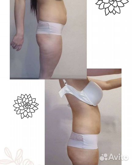 Массаж лица и тела