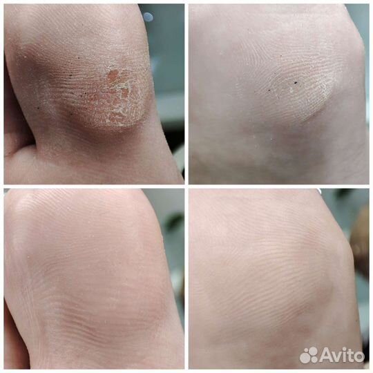 Маникюр педикюр качественно быстро