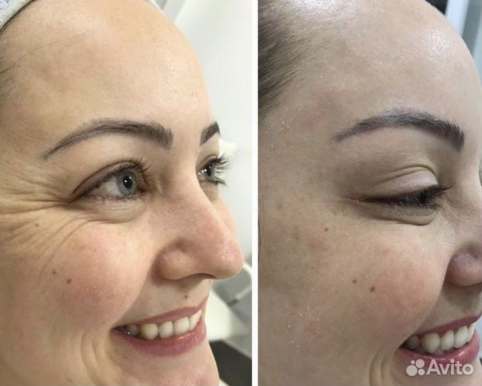 Услуги косметолога