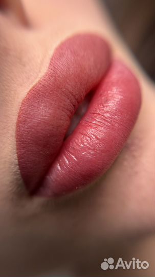 Косметолог губы ботокс