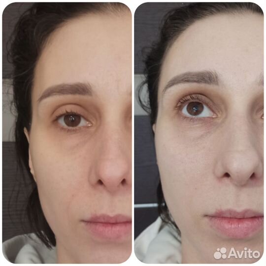 Ручной и аппаратный Массаж, массаж лица. Обучение